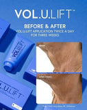 VOL.U.LIFT™ GLP-1 4D Skin Rebound Complex