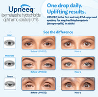 Upneeq Lid Lifting Eyedrops