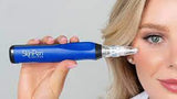 SkinPen Microneedling